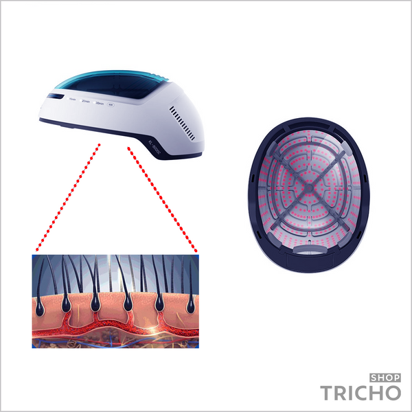 Лазерный шлем против выпадения волос на основе LLLT+ LED, KN-8000C 2302 фото