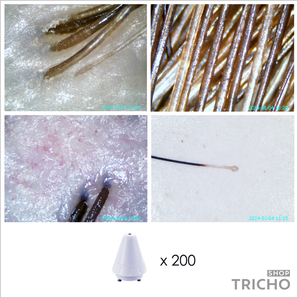 Трихоскоп для диагностики волос и кожи головы з программой, 5 линз: х1, х50, х50 UV, х200, х800 1019 фото