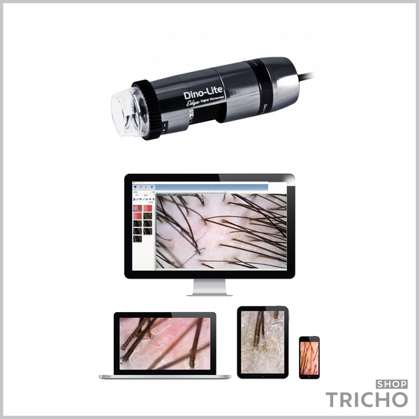 Трихоскоп цифровий USB TrichoScope Polarizer HR MEDL7HM 1005 фото