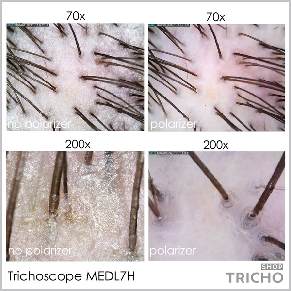 Трихоскоп цифровой USB TrichoScope Polarizer HR MEDL7HM 1005 фото