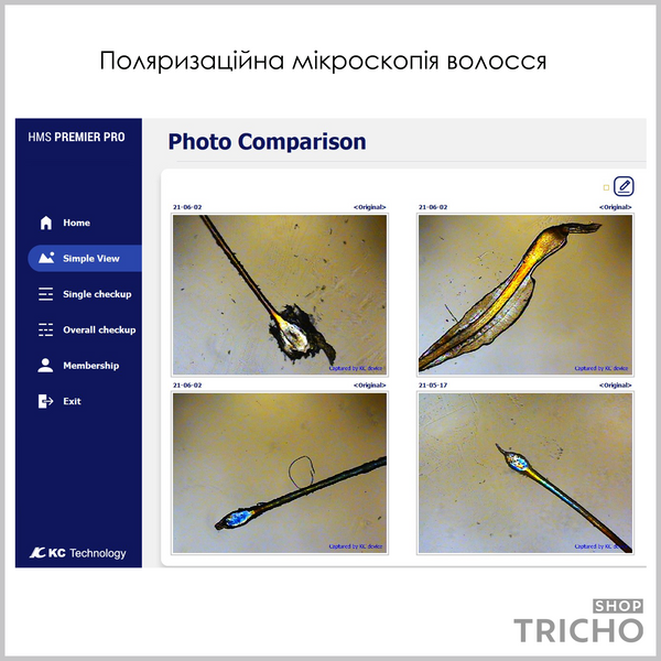 Трихоскоп КС Hair Polarizer, комплектация "Expert" 1009 фото